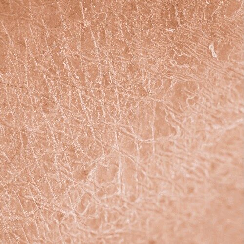 a close-up image of a dry skin in the face