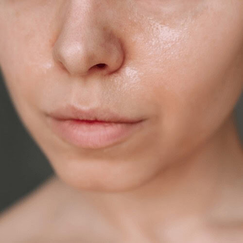 An image seeing the nose up to the chin with an oily face